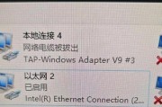 Win10本地连接不见了，如何恢复？（解决方法一键搞定，让你的本地连接重新出现）